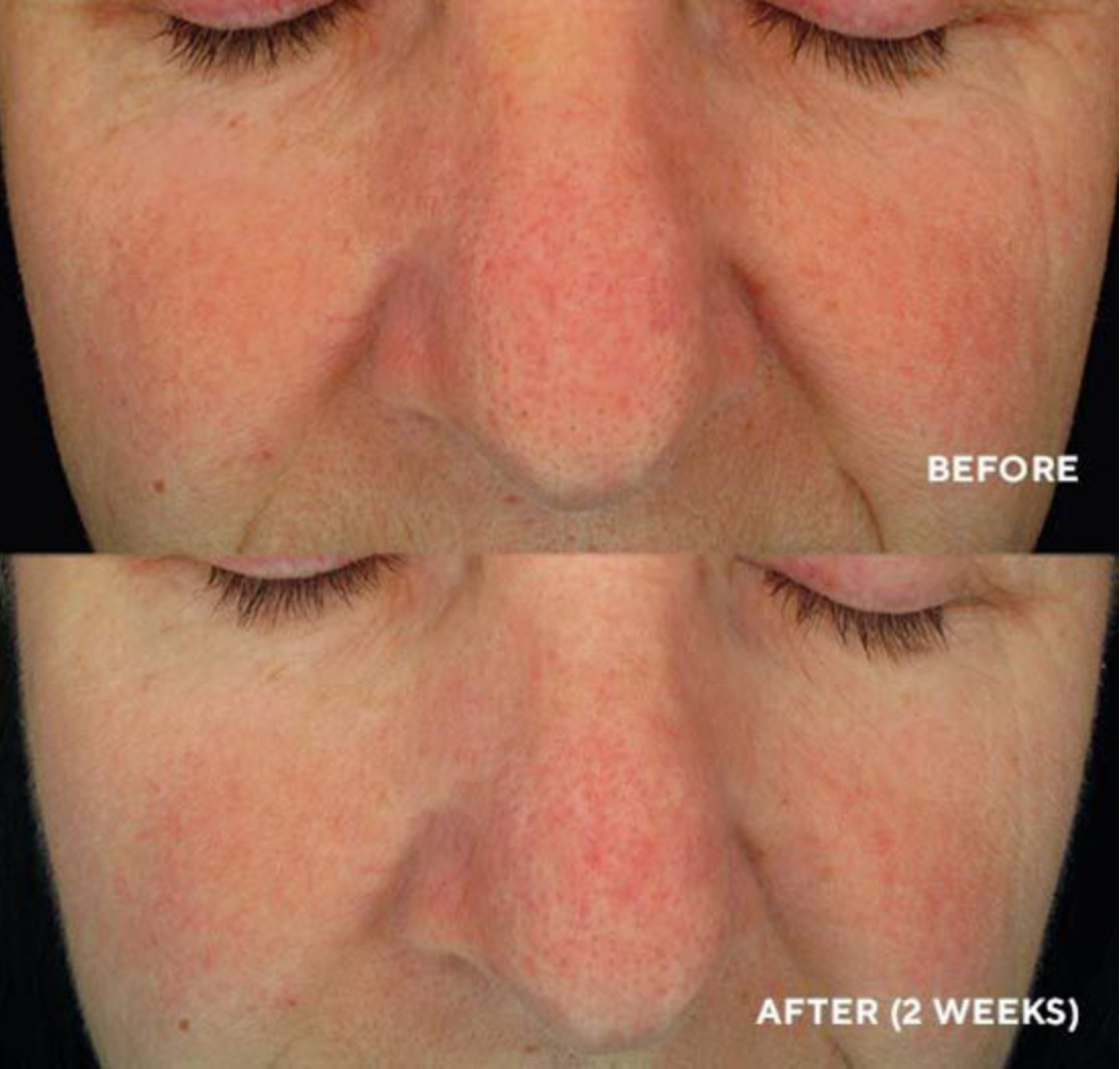 HydroPeptide Soothing Serum