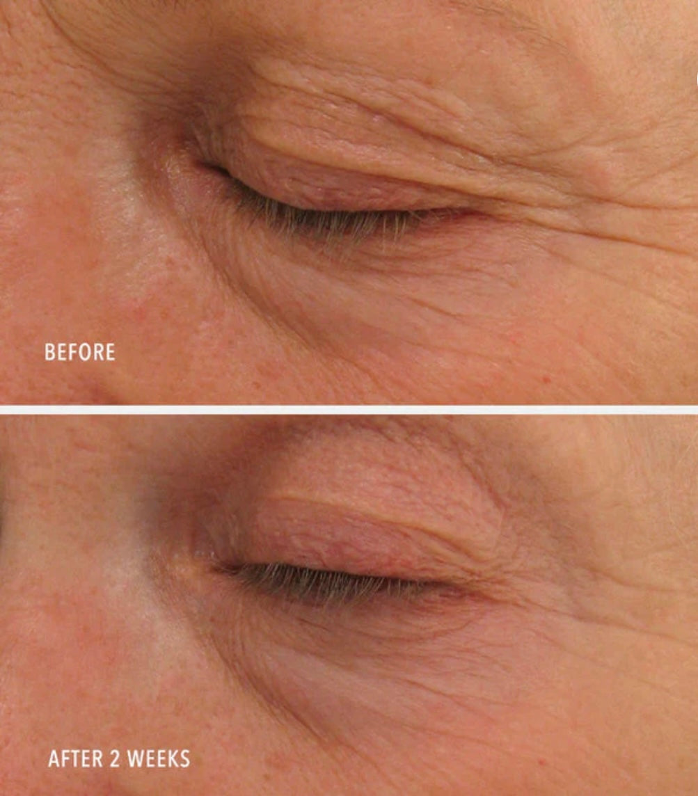 Hydropeptide Eye Authority