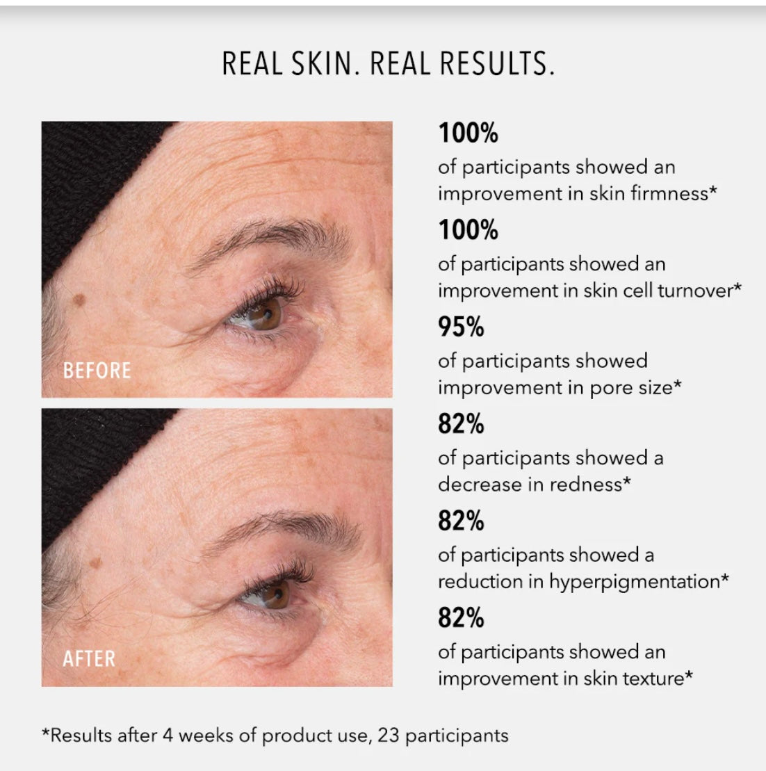 Hydropeptide Liquid Resurfacing Solution